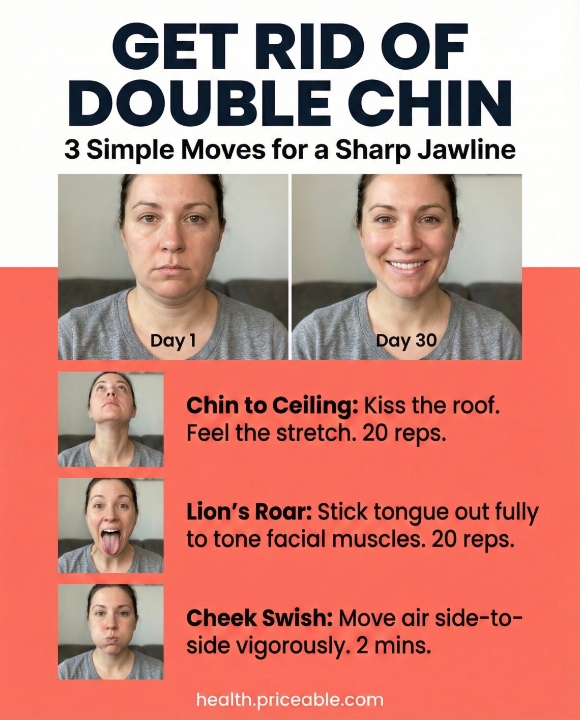Laser Double Chin Removal