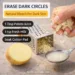 potato juice for dark circles