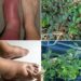 Mimosa Pudica Remedy for Swelling & Inflammation Relief