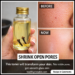 DIY clove toner for pores