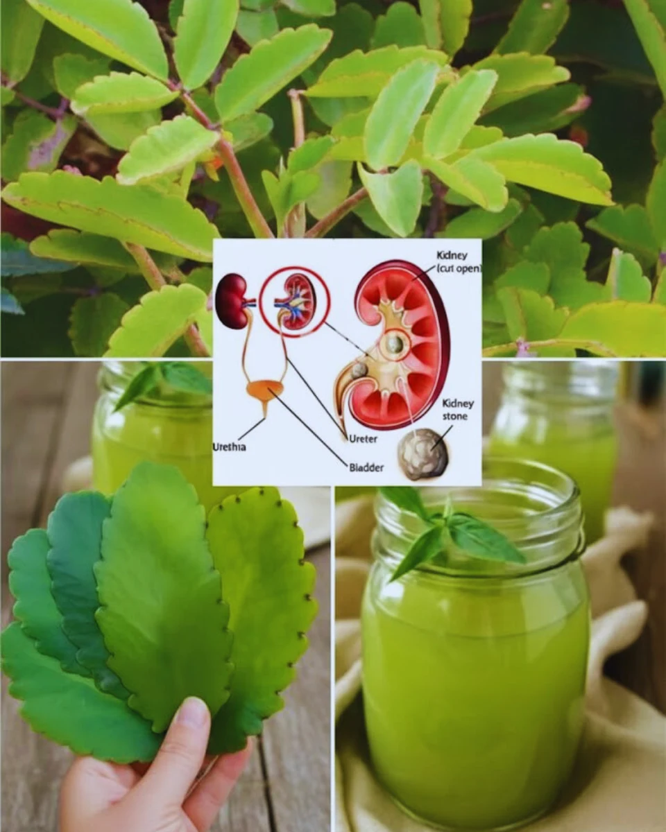 Kalanchoe pinnata - kidney stone relief 