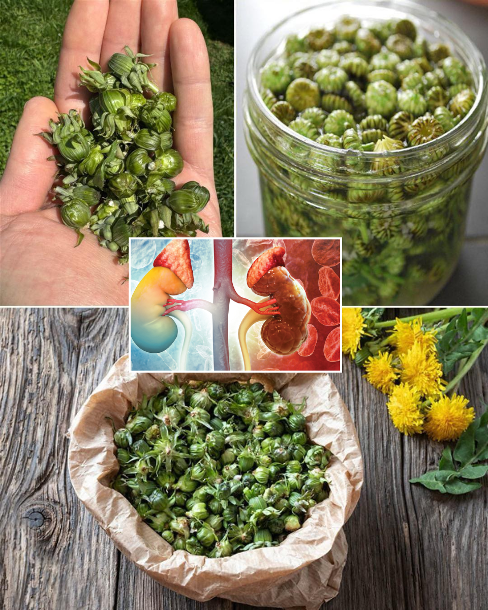Dandelion Buds for Kidney Support