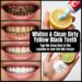 yellow teeth whitening