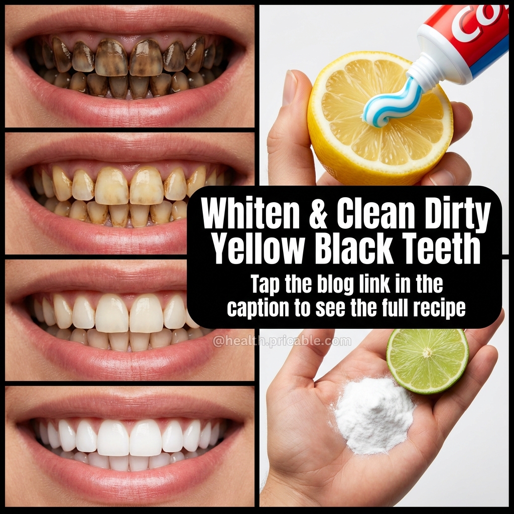 yellow teeth whitening