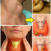 Ginger for Thyroid Swelling? What This Traditional Remedy Can and Cannot Do