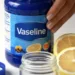 9 Gentle Vaseline Skin Remedies