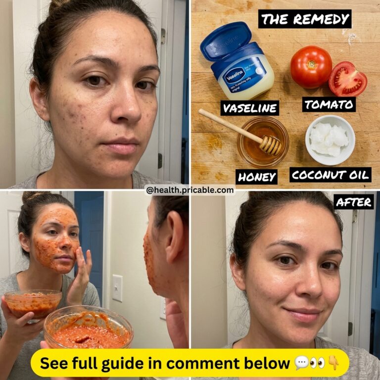 A detailed collage showing a before photo of skin the ingredients Vaseline tomato honey coconut oil a woman applying the