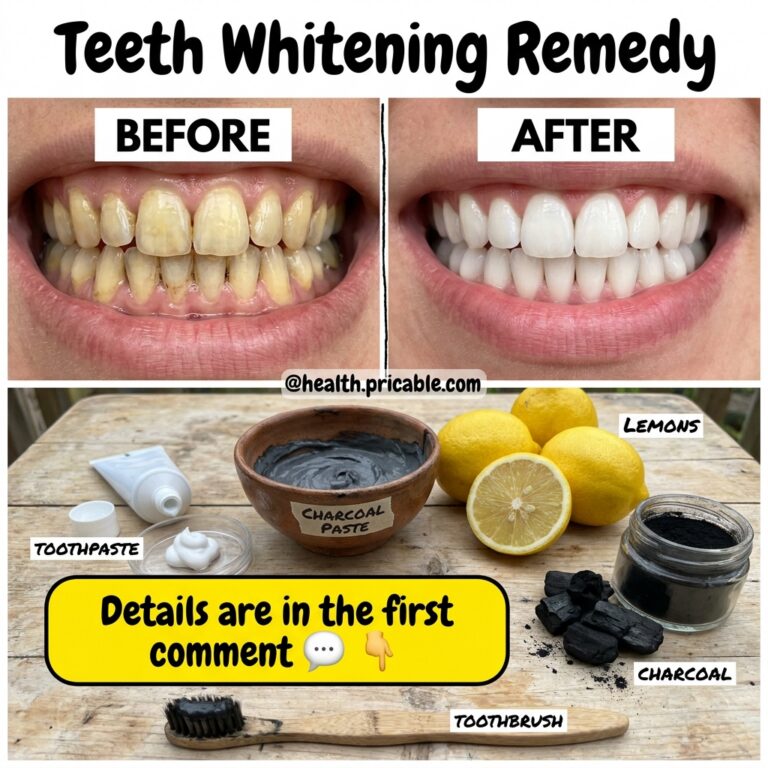 A composite image showing before and after teeth whitening alongside activated charcoal chunks lemon slices charcoal pas