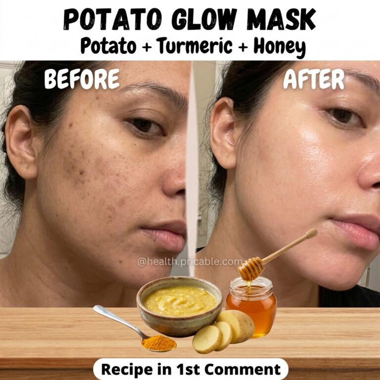 A clear before and after comparison of a woman s face showing skin with dark spots and uneven tone on the left BEFORE an