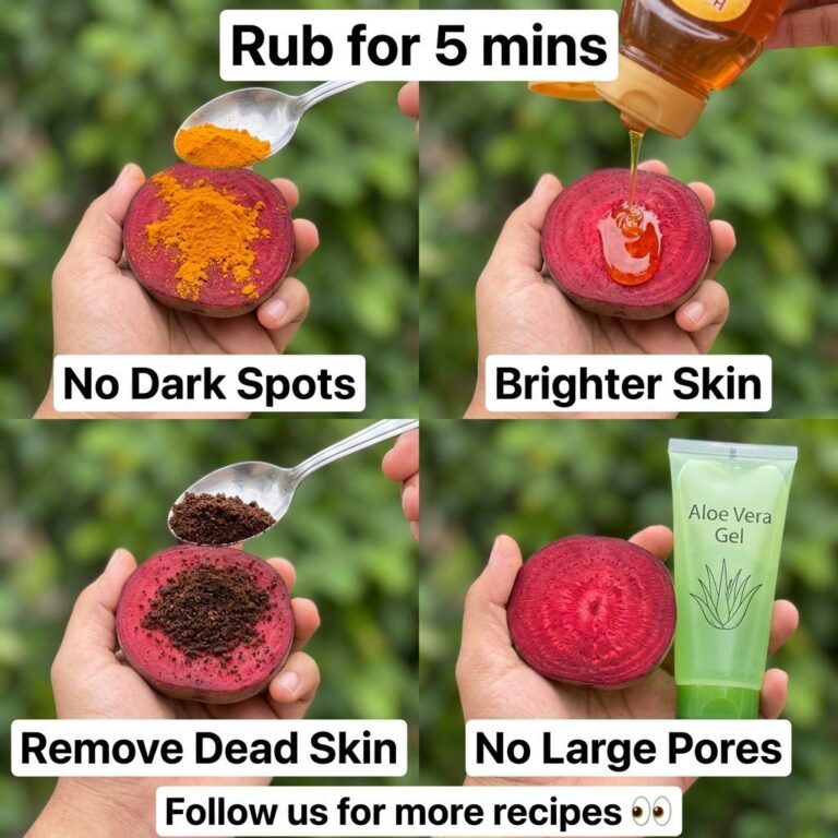 A multi-panel image showing four DIY beetroot remedies beetroot with turmeric for dark spots beetroot with honey for bri