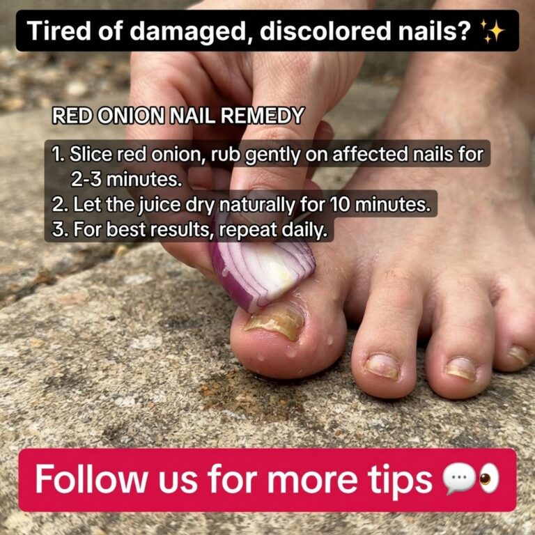 Close-up of a hand rubbing a slice of red onion on a damaged discolored toenail