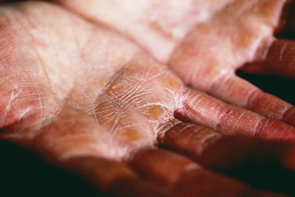 Close-up of a hand gently applying a small amount of Vaseline mix to a dark spot on the skin