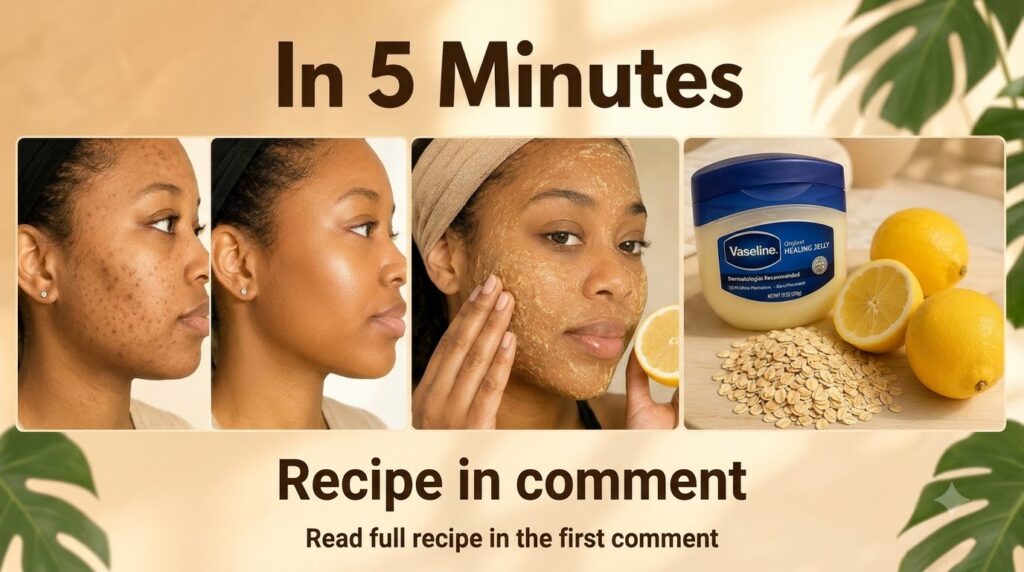 A four-panel collage showing a woman s before and after skin transformation blemished to glowing her applying a natural 