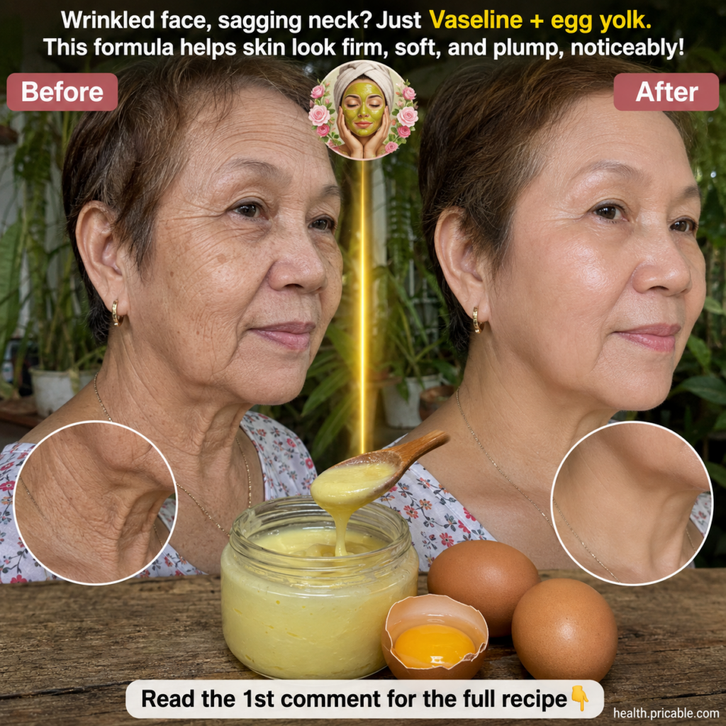 A split before and after image of an elderly woman s face and neck with the after side showing noticeably smoother skin