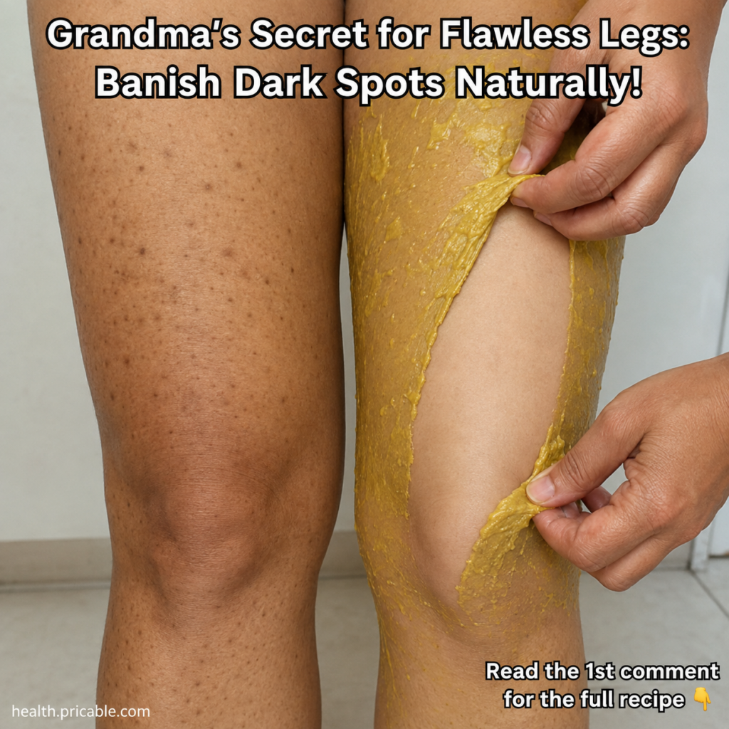 A close-up of a leg with dark spots on one side and a mustard yellow peeling mask being removed from the other side reve