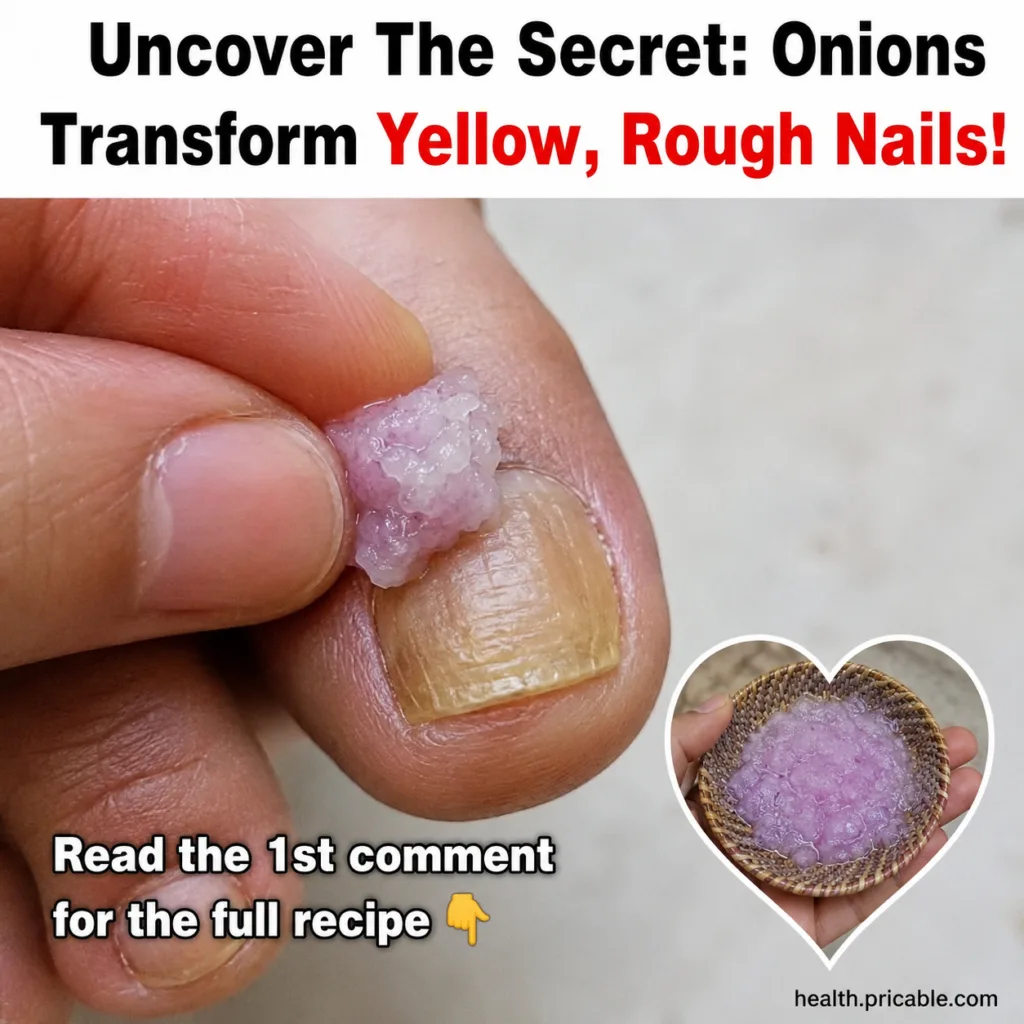 A close-up of a hand applying a light pink granular paste to a discolored yellowish toenail The paste is visibly on the 