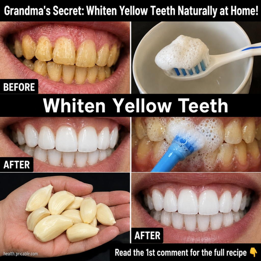 A split image showing yellow teeth BEFORE on one side and sparkling white teeth AFTER on the other with peeled garlic cl