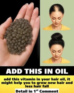 Ingredients for a homemade hair growth oil including a small bottle of Vitamin E oil and a larger bottle of carrier oil 