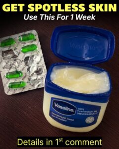 An open tub of Vaseline and a blister pack of green oval Vitamin E capsules laid out on a dark surface ready for mixing