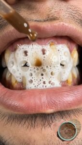 Ingredients for natural teeth whitening paste a small bowl of baking soda a jar of coconut oil and a small glass of pepp