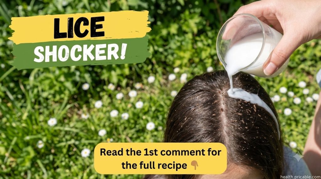 A person s scalp infested with lice and nits with a hand pouring a white liquid treatment onto the hair The background i