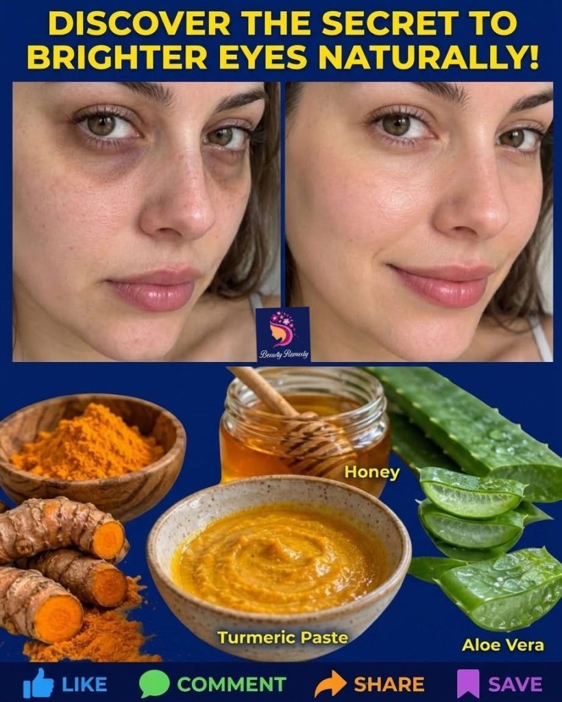 A before-and-after comparison of a woman s face showing reduced under-eye circles and a brighter complexion after using 