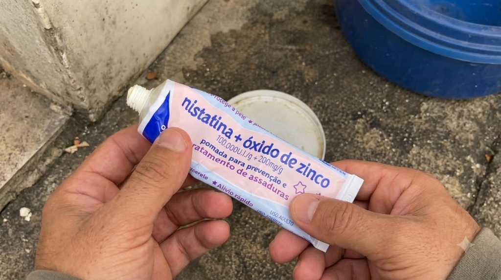 A close-up vertical shot of a hand holding a tube of nistatina óxido de zinco cream with the cap off revealing cream at 