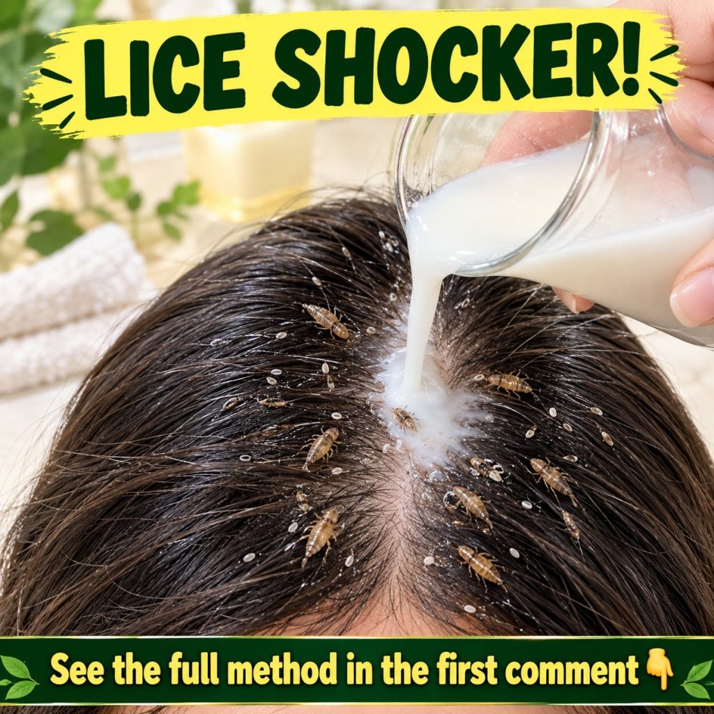 A split image showing a before scalp with visible lice and nits and an after scalp looking clean and healthy The before 